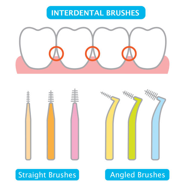 brossettes interdentaires